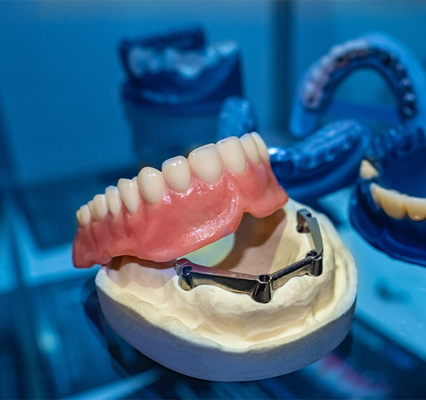 Dental Prostheses Salaberry