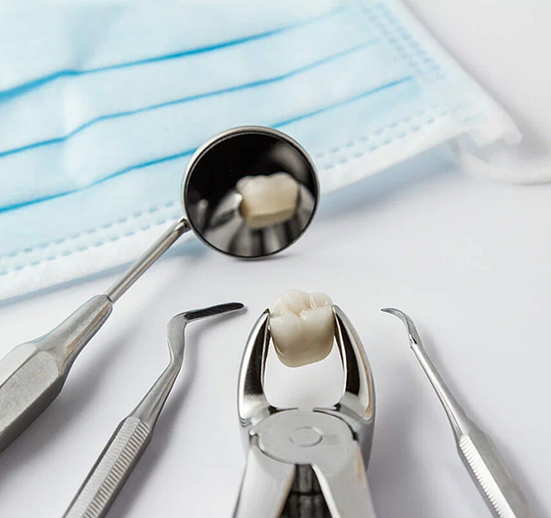 Tooth Extraction salaberry