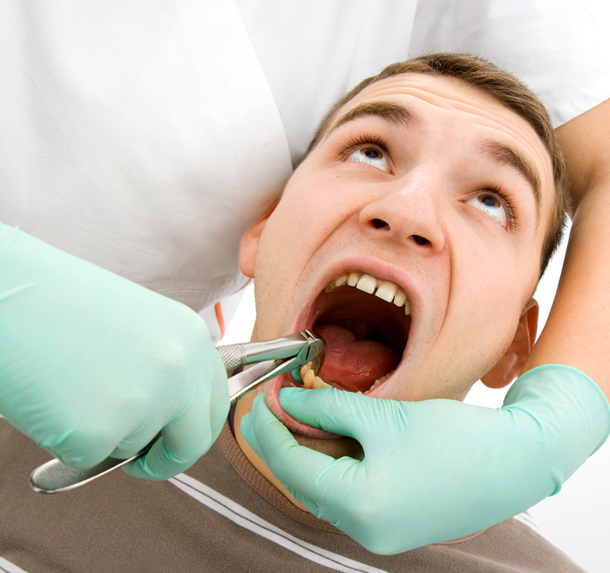 Tooth Extraction salaberry