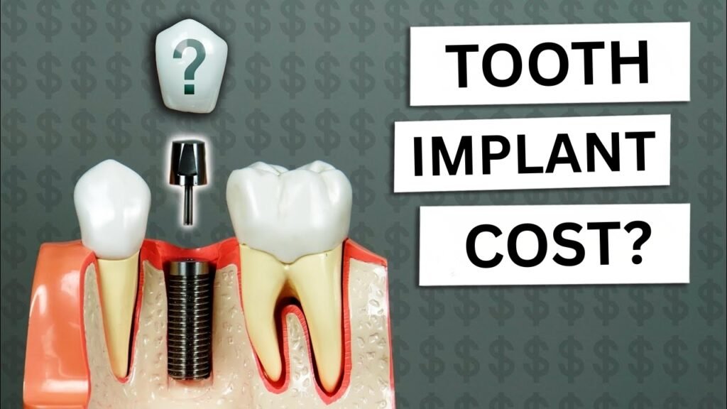 How Much Is a Tooth Implant