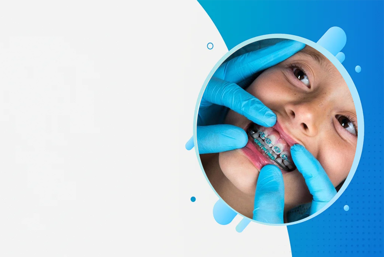 Interceptive Orthodontics