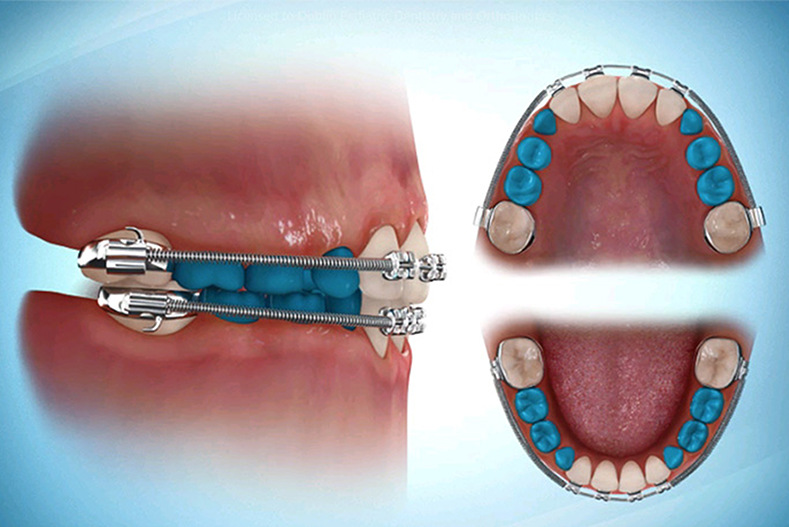Interceptive Orthodontics